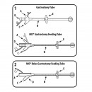 AVANOS* Gastrostomy Feeding Tubes